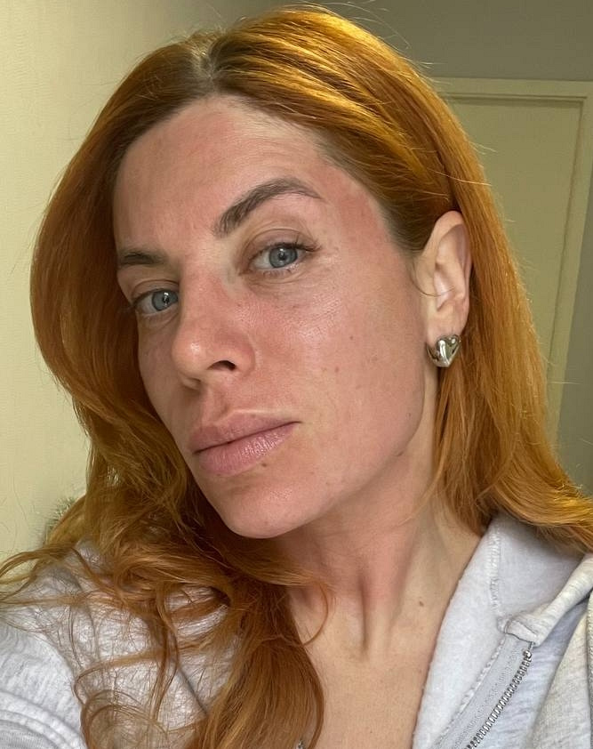 Одразу після лазерної шліфовки