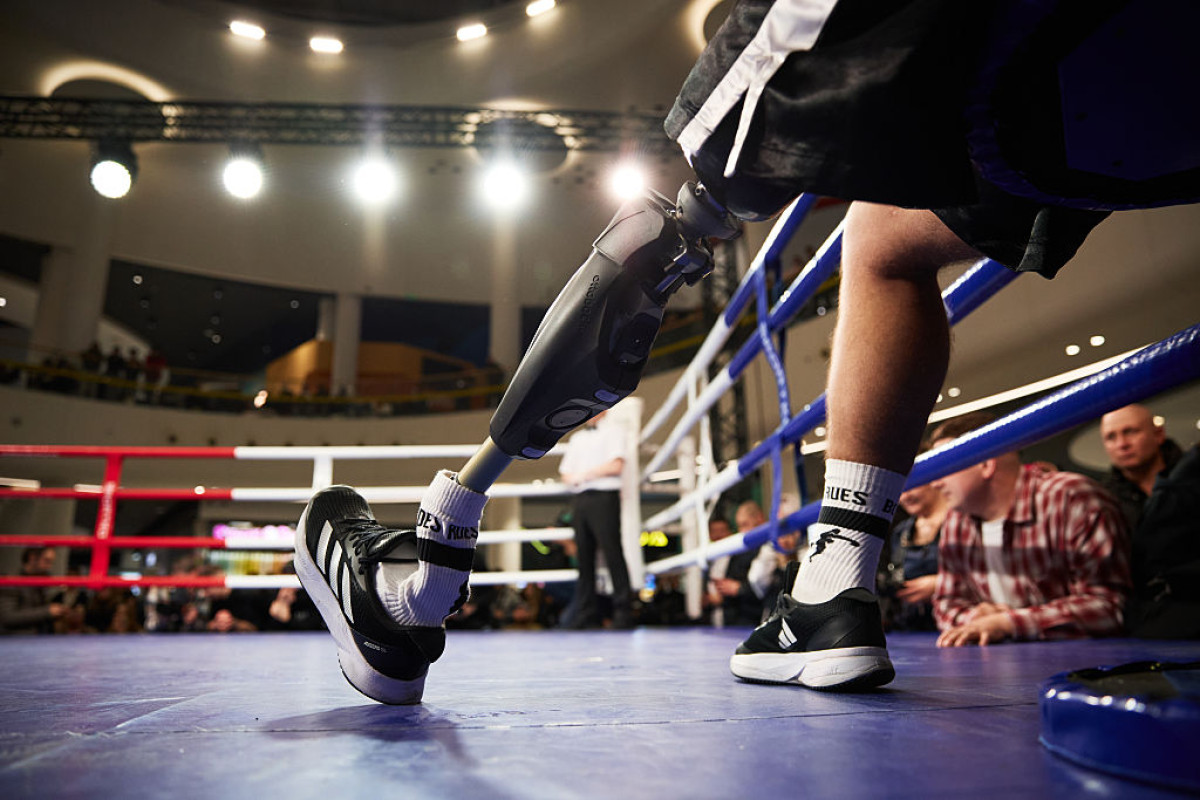 Протезування