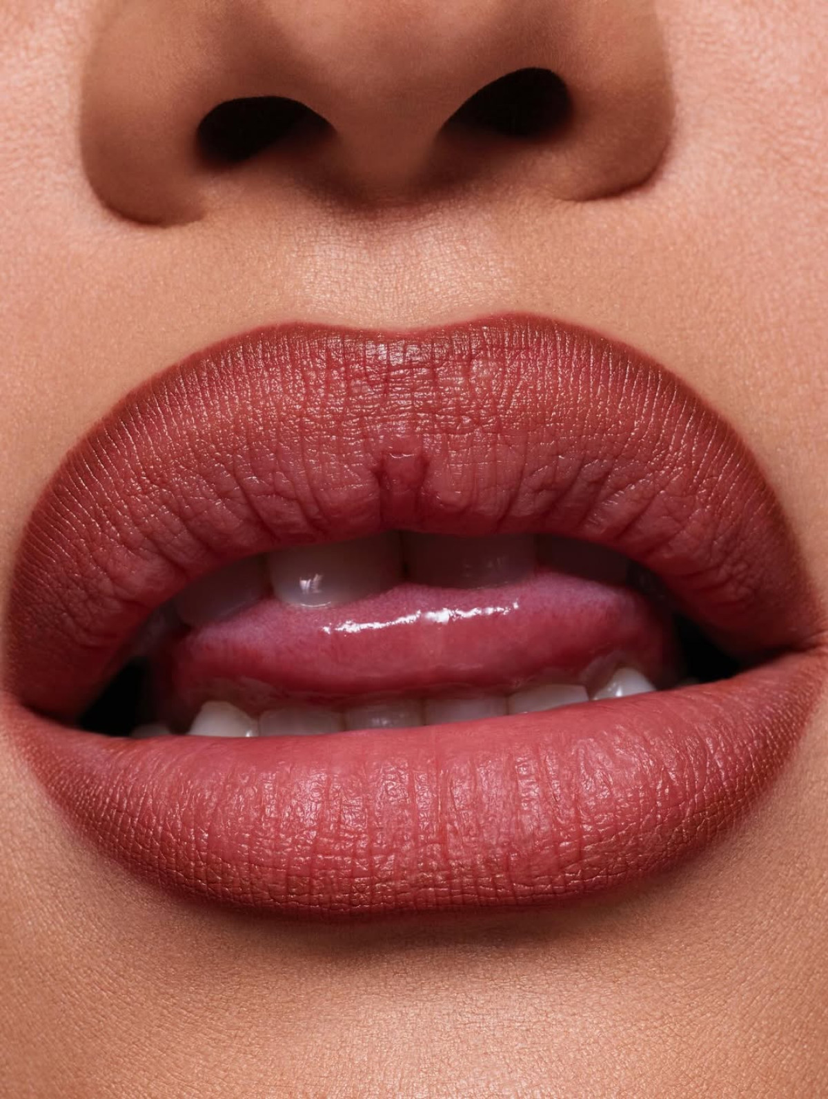 збільшення губ побічні ефекти