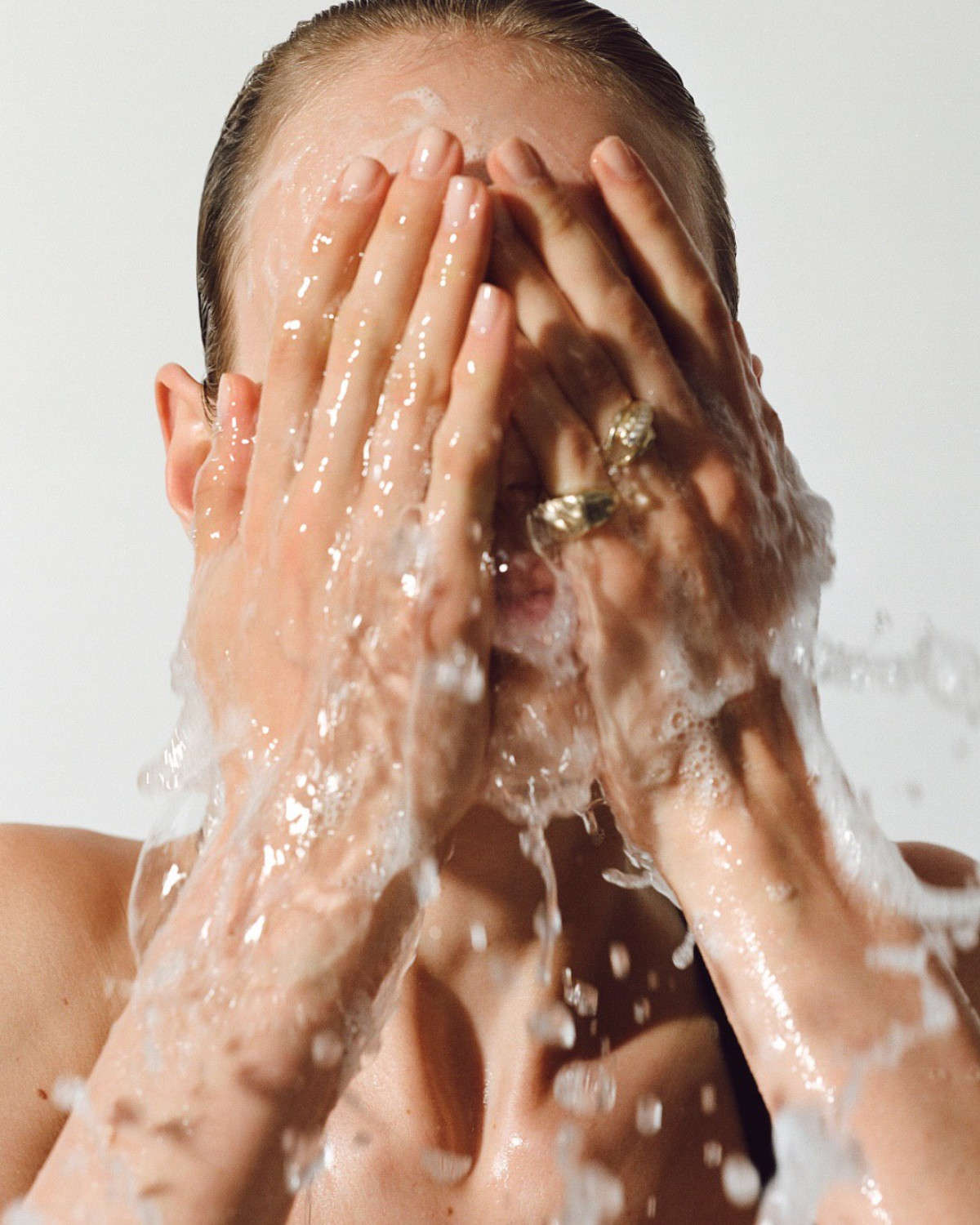 Чи можна вилікувати акне назавжди?